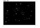 Fig. 24 - NUTRITIONAL COMPOSITIONS CONTAINING A NEUROLOGIC COMPONENT AND USES THEREOF