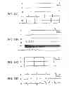 Fig. 13 - Modulation of bio-electrical rhythms via a novel engineering approach
