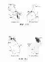 Fig. 15 - Modulation of bio-electrical rhythms via a novel engineering approach