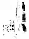 Fig. 23 - Method for the treatment of acne by administering IL-1β antibody