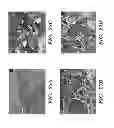 Fig. 28 - Methods for treating and preventing neutrophil-derived net toxicity and thrombosis