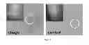 Fig. 04 - Controlled covalent attachment of bioactive bacteriophage for regulating biofilm development