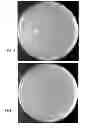 Fig. 05 - MICROBIAL GROWTH FACTORS