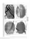 Fig. 19 - Nanoparticle and polymer formulations for thyroid hormone analogs, antagonists, and formulations thereof