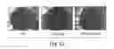 Fig. 64 - Nanoparticle and polymer formulations for thyroid hormone analogs, antagonists, and formulations thereof