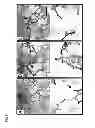 Fig. 09 - USE OF TGF-BETA ANTAGONISTS TO TREAT INFANTS AT RISK OF DEVELOPING BRONCHOPULMONARY DYSPLASIA