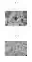 Fig. 02 - Active agent loaded uniform, rigid, spherical, nanoporous calcium phosphate particles and methods of making and using the same
