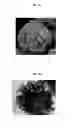 Fig. 03 - Active agent loaded uniform, rigid, spherical, nanoporous calcium phosphate particles and methods of making and using the same