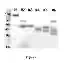 Fig. 04 - Barley with low levels of hordeins
