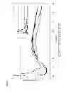 Fig. 02 - Cement Hydrate Products For Sprayed Concrete