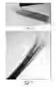 Fig. 04 - MULTI-BRANCHED N-DOPED CARBON NANOTUBES AND THE PROCESS FOR MAKING SAME