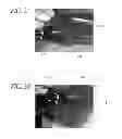 Fig. 03 - Hydraulic pressure dental impression
