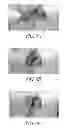 Fig. 07 - Hydraulic pressure dental impression