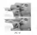 Fig. 11 - Hydraulic pressure dental impression