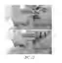 Fig. 12 - Hydraulic pressure dental impression