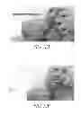 Fig. 13 - Hydraulic pressure dental impression
