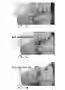 Fig. 17 - Hydraulic pressure dental impression