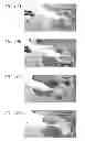 Fig. 25 - Hydraulic pressure dental impression