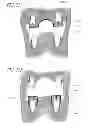 Fig. 28 - Hydraulic pressure dental impression