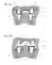 Fig. 29 - Hydraulic pressure dental impression