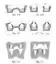Fig. 34 - Hydraulic pressure dental impression
