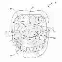 Fig. 01 - DENTAL TRAP