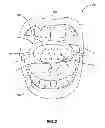 Fig. 03 - DENTAL TRAP