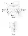 Fig. 04 - DENTAL TRAP