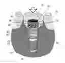 Fig. 01 - Dental retention systems