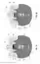 Fig. 04 - Dental retention systems