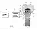 Fig. 05 - Dental retention systems