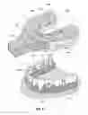 Fig. 07 - Dental retention systems