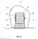 Fig. 15 - Dental retention systems