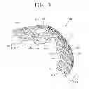 Fig. 04 - Membrane for alveolar bone regeneration
