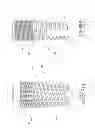 Fig. 02 - DENTAL IMPLANT WITH MULTIPLE THREAD PATTERNS