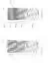 Fig. 07 - DENTAL IMPLANT WITH MULTIPLE THREAD PATTERNS