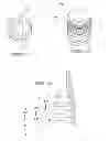 Fig. 09 - DENTAL IMPLANT WITH MULTIPLE THREAD PATTERNS