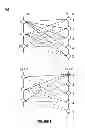 Fig. 03 - Comprehension normalization