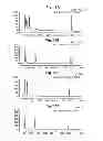 Fig. 26 - METHODS OF FETAL ABNORMALITY DETECTION