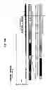 Fig. 35 - METHODS OF FETAL ABNORMALITY DETECTION
