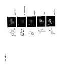 Fig. 09 - Translational dysfunction based therapeutics