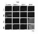 Fig. 02 - METHOD FOR DETECTING CANCER CELLS METASTASIZING INTO SENTINEL LYMPH NODE