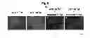 Fig. 06 - METHOD FOR DETECTING CANCER CELLS METASTASIZING INTO SENTINEL LYMPH NODE