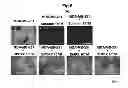 Fig. 07 - METHOD FOR DETECTING CANCER CELLS METASTASIZING INTO SENTINEL LYMPH NODE