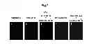 Fig. 08 - METHOD FOR DETECTING CANCER CELLS METASTASIZING INTO SENTINEL LYMPH NODE