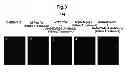 Fig. 09 - METHOD FOR DETECTING CANCER CELLS METASTASIZING INTO SENTINEL LYMPH NODE