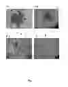Fig. 05 - Kit and method for the capture of tumor cells