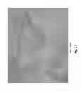 Fig. 23 - Atomic layer deposition inverted passivated surface acoustic wave sensor for early detection of biofilm growth
