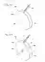 Fig. 17 - Resin coating device, and resin coating method