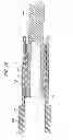 Fig. 18 - TELESCOPIC SHAFT